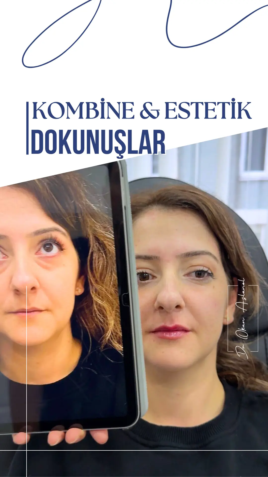 KOMBİNE ESTETİK İŞLEMLER