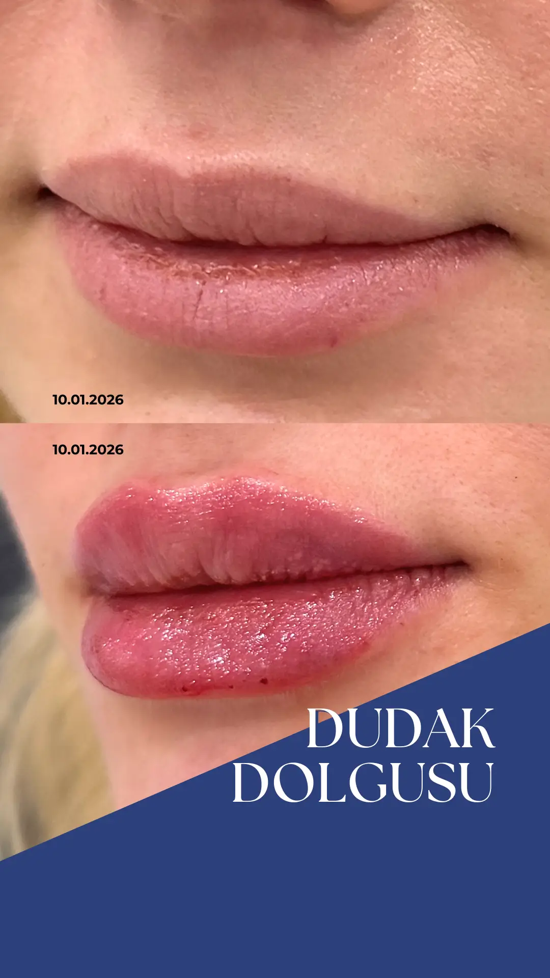 OKAN HOCA-DUDAK-3 (1)