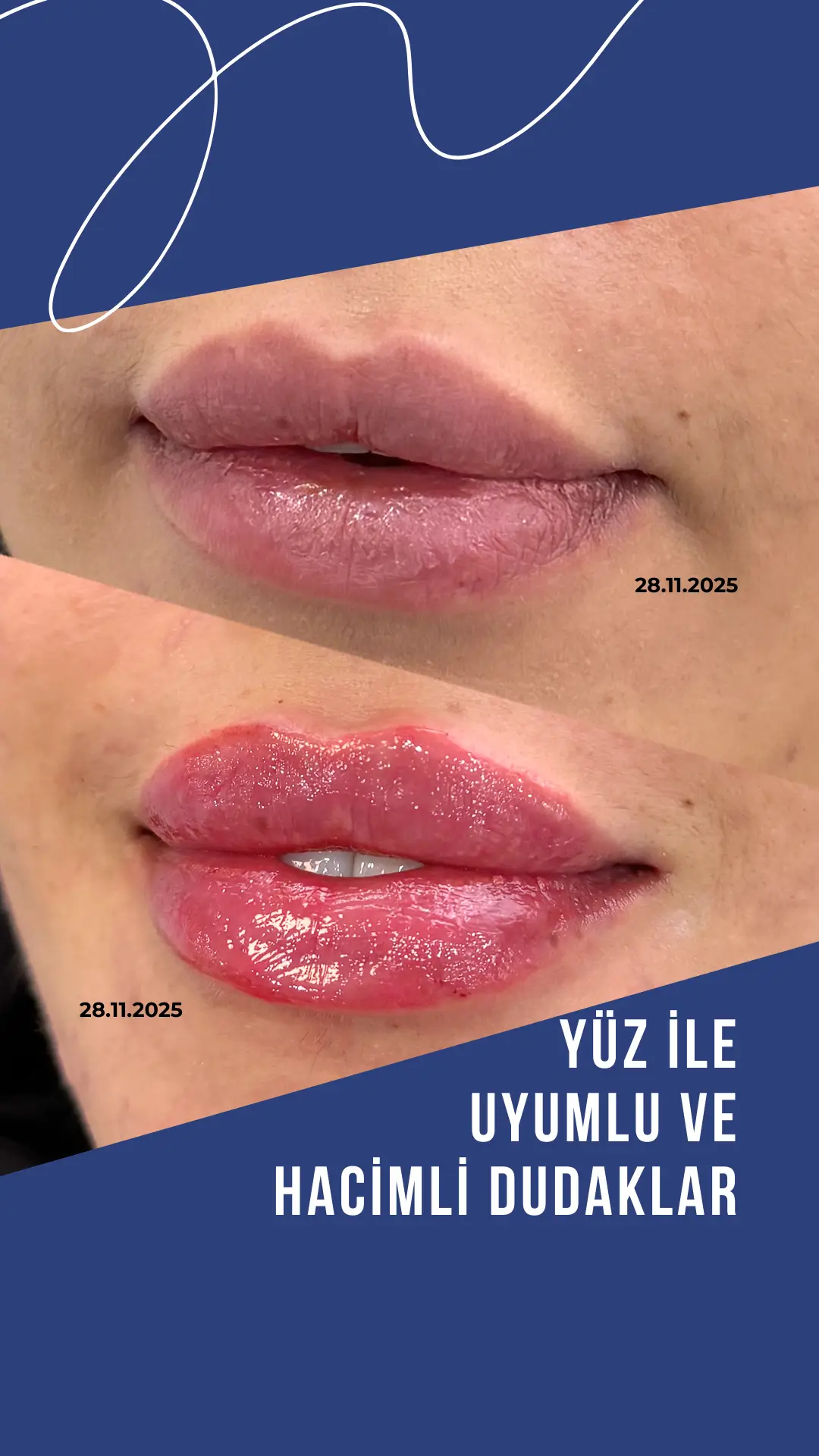 OKAN HOCA-DUDAK-3 (2)